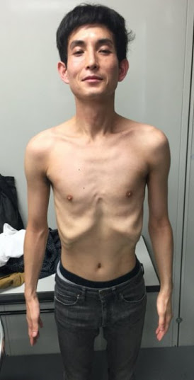 カラテカ矢部　朝食代わりに葛根湯　41キロの激やせ生活が明らかに