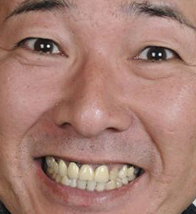 歯並びが悪い（悪かった）芸能人を挙げていくトピ