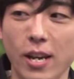 歯並びが悪い（悪かった）芸能人を挙げていくトピ