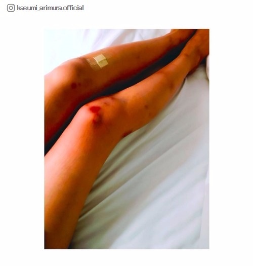 自撮りで引いてしまった有名人（インスタグラムにて）