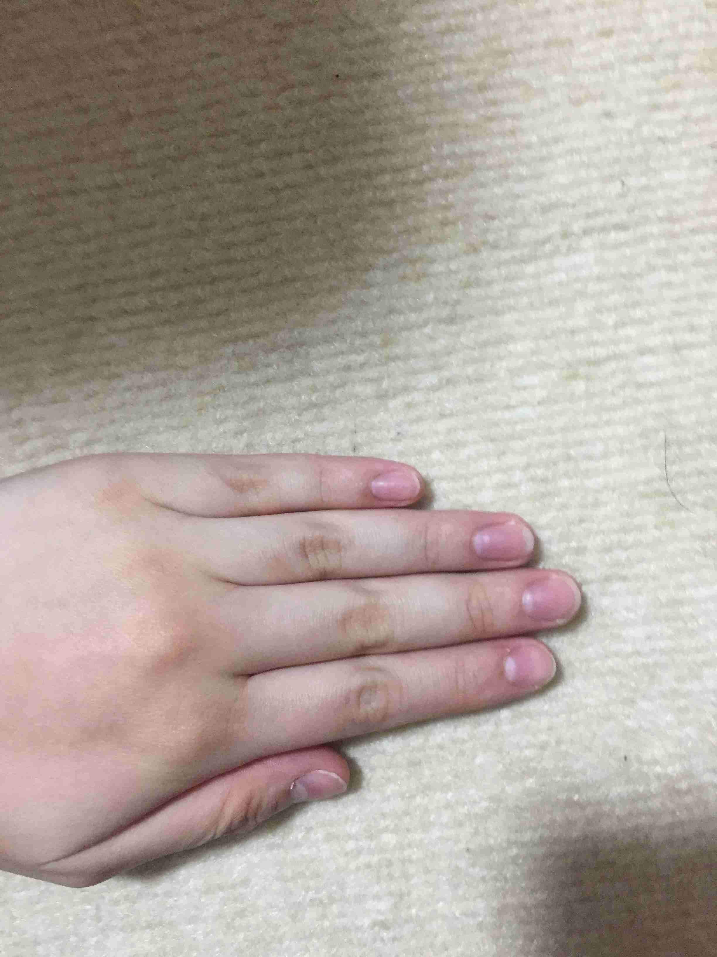 爪を噛む癖をなおしたい