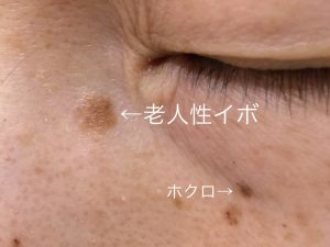 肌が綺麗になった食生活