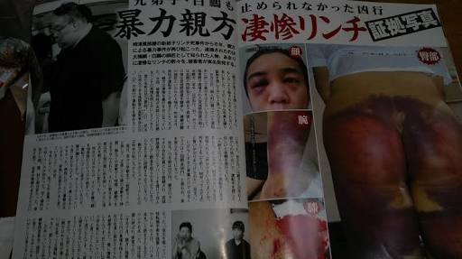 白鵬、節目の場所に向け立ち合いの悪癖改善へ