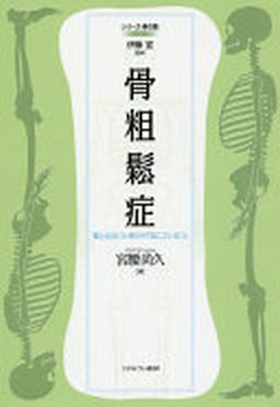 骨粗しょう症の予防の為に何かしてますか?