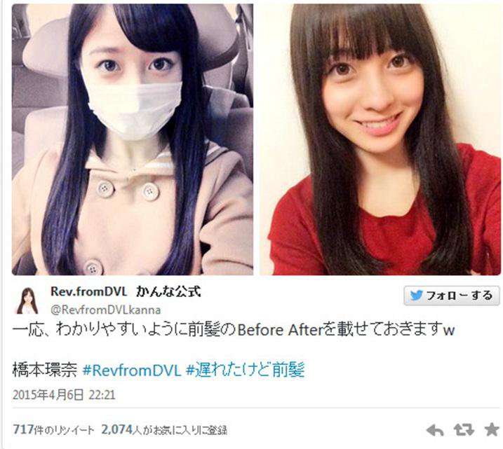 高須克弥院長が10代女優の顔をランキング化 ナンバーワンは広瀬すず