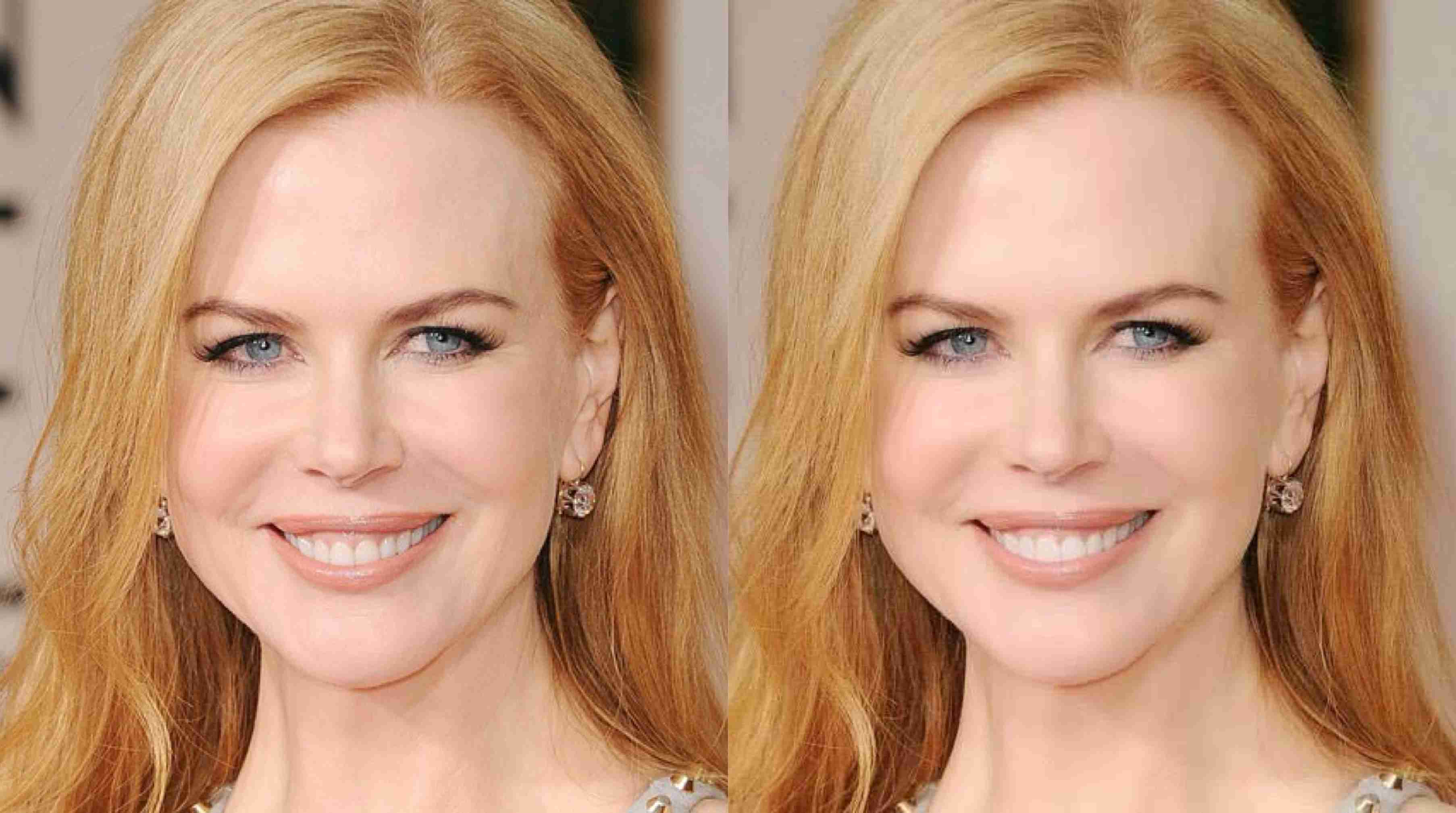 美しかったニコール・キッドマン、ついに不自然顔に!?