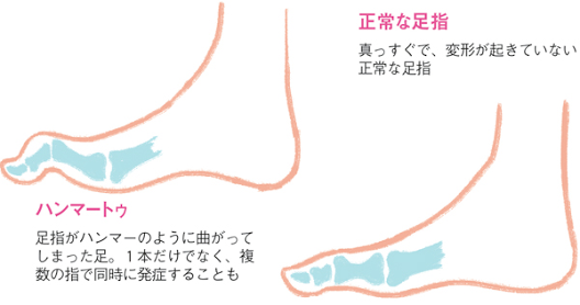 ストラップのないパンプスを履くコツ