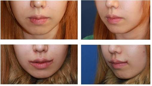 ハイレベルなコスプレと雑なコスプレが見たい