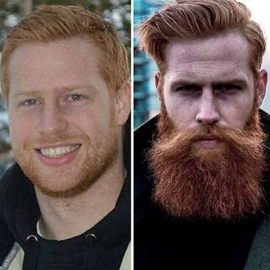 「ヒゲを生やしたら？」とアドバイスされたメタボ男性、現在はイケメンモデルに大変身を遂げる