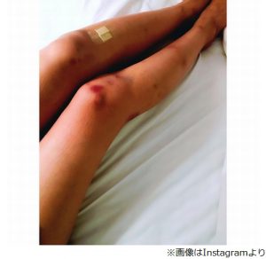 石田ゆり子のインスタもイタすぎる!? 竹内涼真、木村文乃… 意外とSNSが不評な芸能人たち