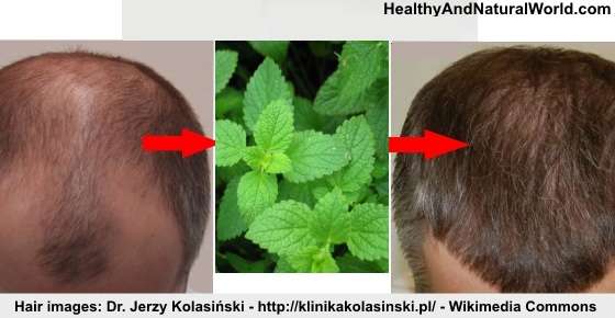ペパーミントに抗男性ホルモン作用を確認・育毛効果に期待!