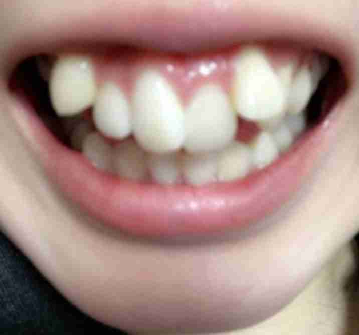 苦手な顔の系統