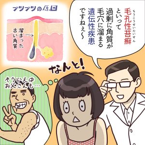 【半袖】二の腕のブツブツ【怖い】