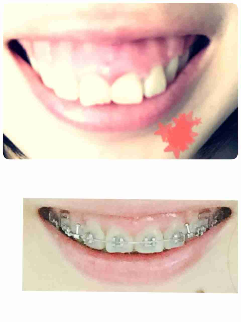 【実況・感想】ナイナイお見合い大作戦　奈良の花嫁 女性からの逆告白SP!