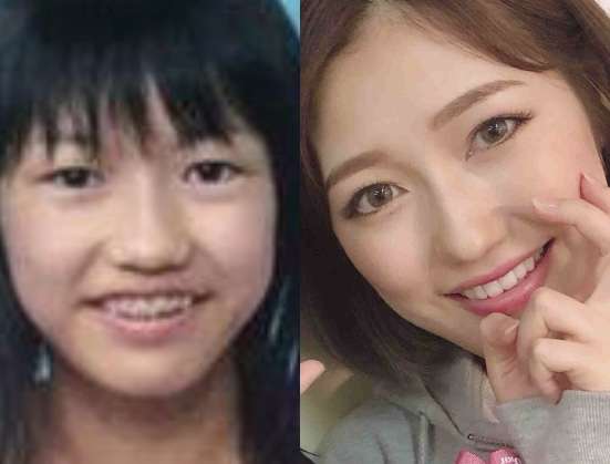 HKT48・宮脇咲良が韓国で「なりたい顔」と超人気に