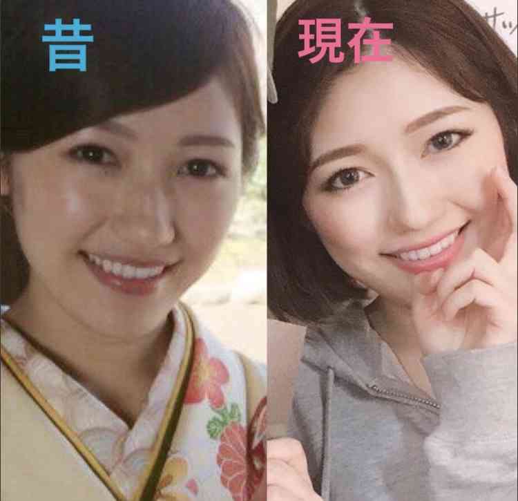 HKT48・宮脇咲良が韓国で「なりたい顔」と超人気に