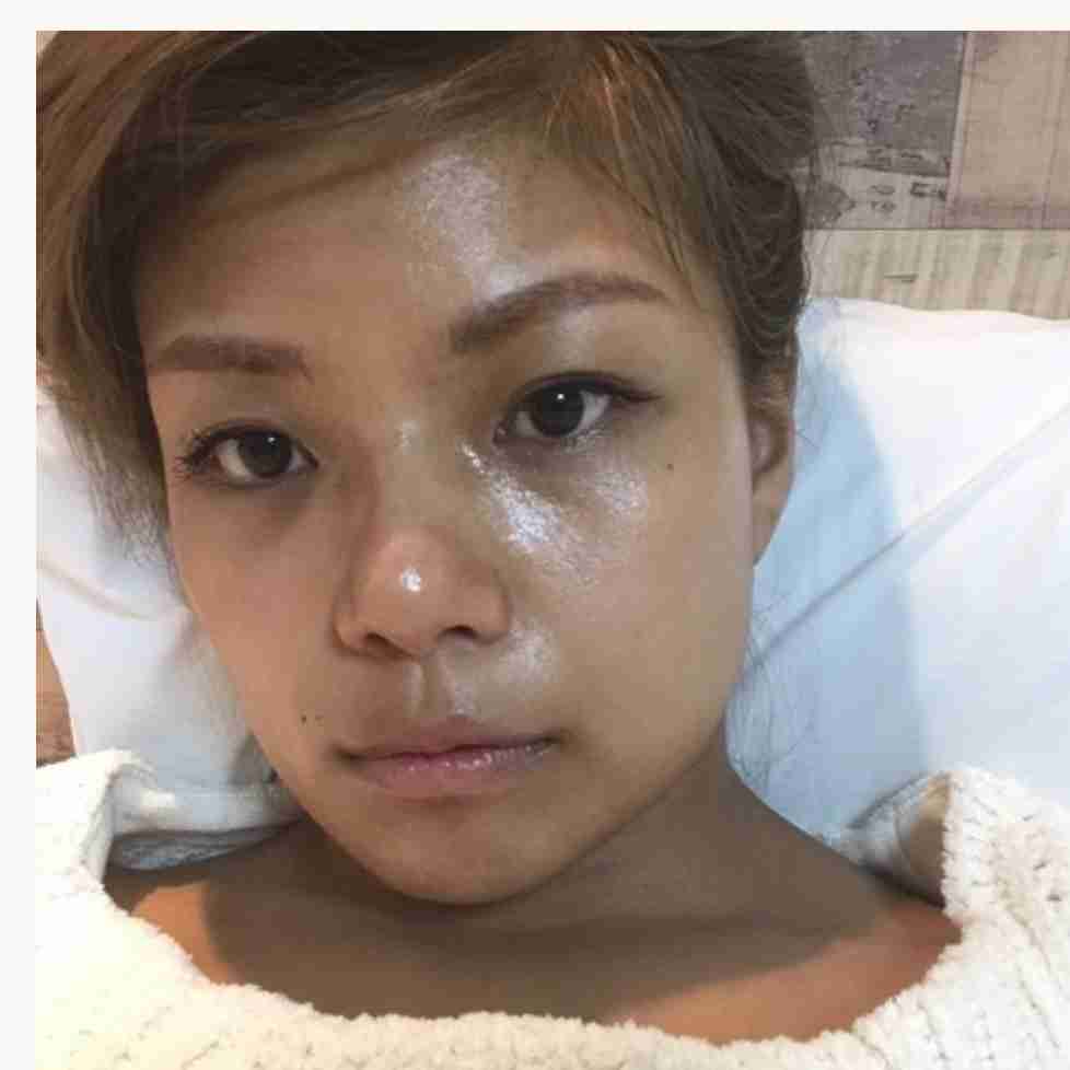 「濃い顔」と「薄い顔」を交互に貼っていくトピ