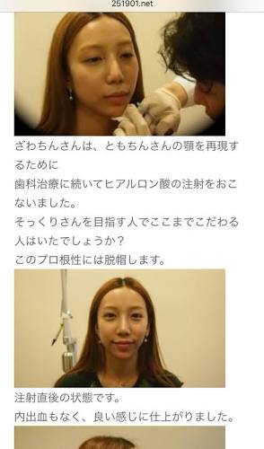 引っ込んでろ!有吉弘行が「ざわちんを許せない」本当の理由とは?