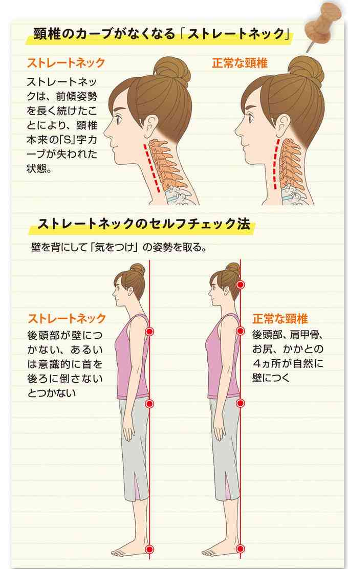 ストレートネックの方