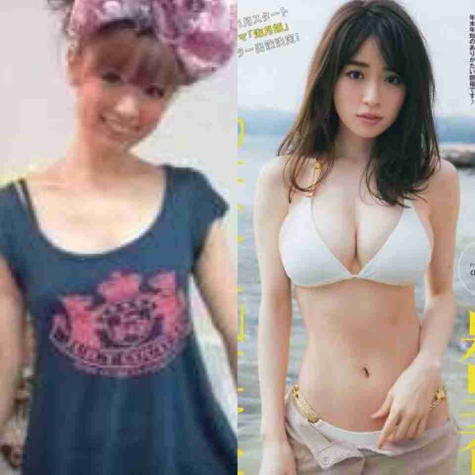 芸能人の整形アンケート調査【プラマイ】