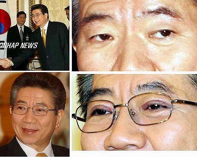 芸能人の整形アンケート調査【プラマイ】