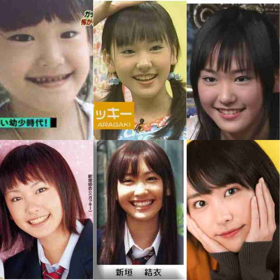 芸能人の整形アンケート調査【プラマイ】