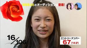 芸能人の整形アンケート調査【プラマイ】
