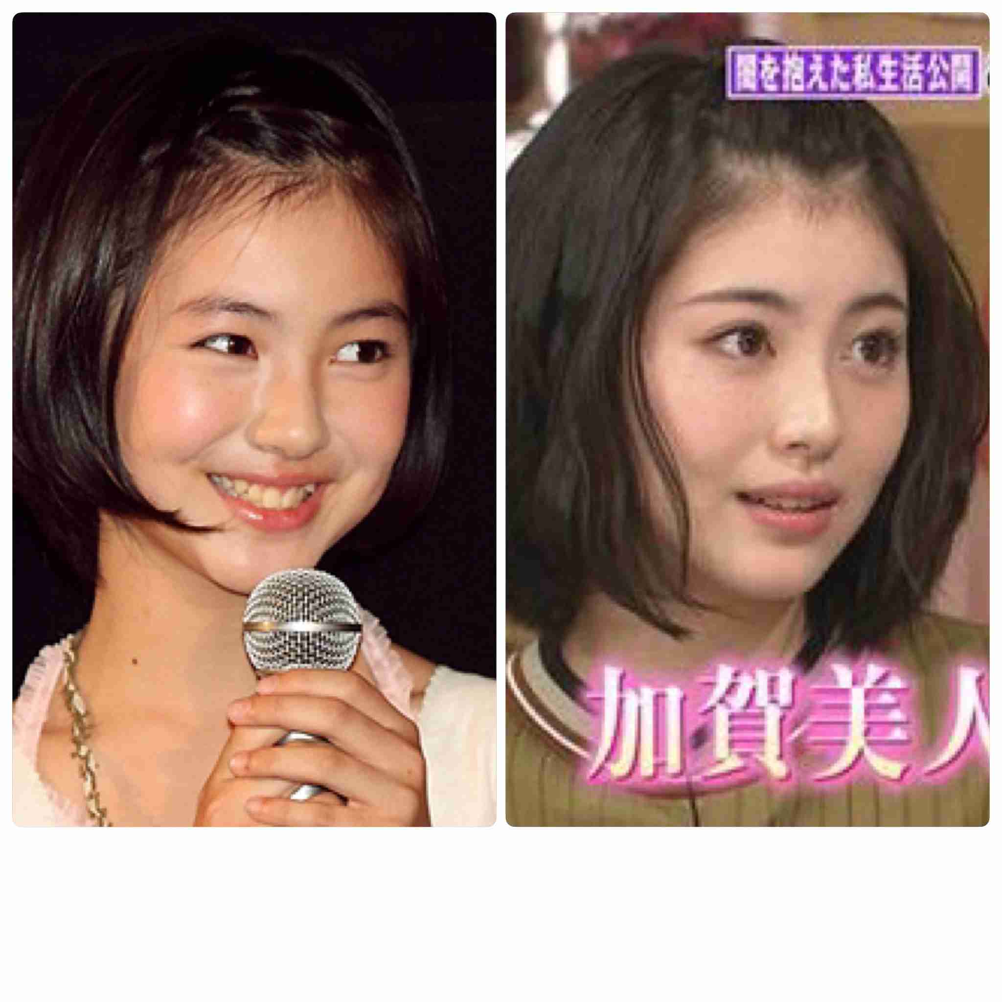 芸能人の整形アンケート調査【プラマイ】