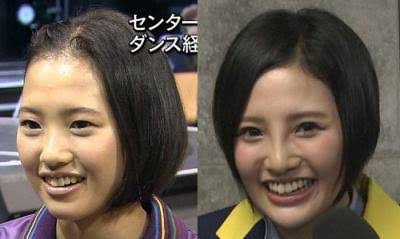 芸能人の整形アンケート調査【プラマイ】