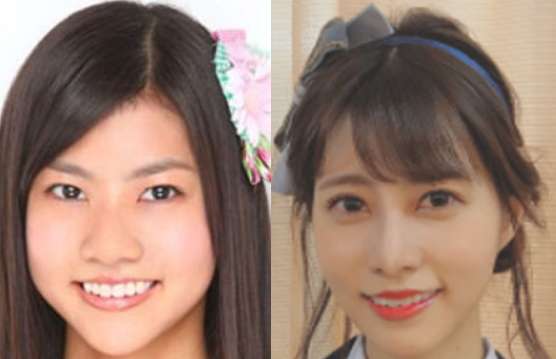 芸能人の整形アンケート調査【プラマイ】