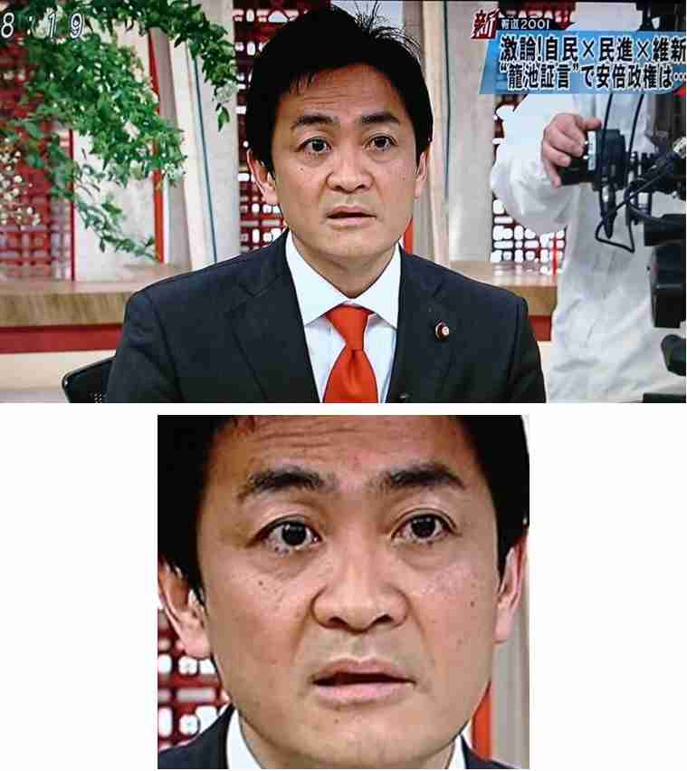 芸能人の整形アンケート調査【プラマイ】