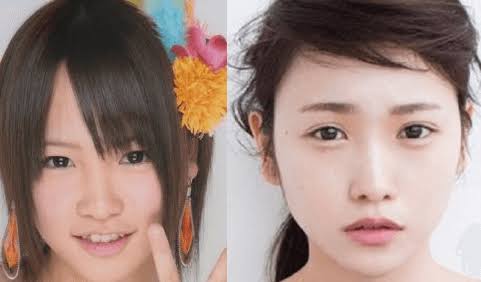 芸能人の整形アンケート調査【プラマイ】
