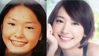 芸能人の整形アンケート調査【プラマイ】