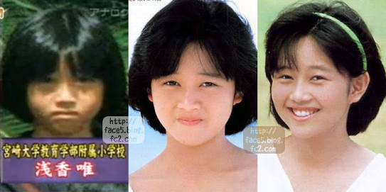 芸能人の整形アンケート調査【プラマイ】