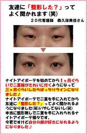 芸能人の整形アンケート調査【プラマイ】