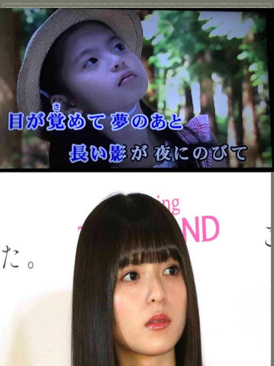 芸能人の整形アンケート調査【プラマイ】
