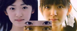 芸能人の整形アンケート調査【プラマイ】