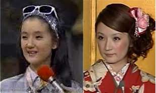 芸能人の整形アンケート調査【プラマイ】