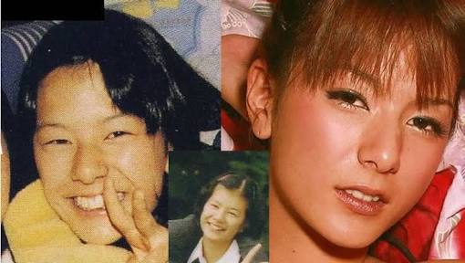 芸能人の整形アンケート調査【プラマイ】