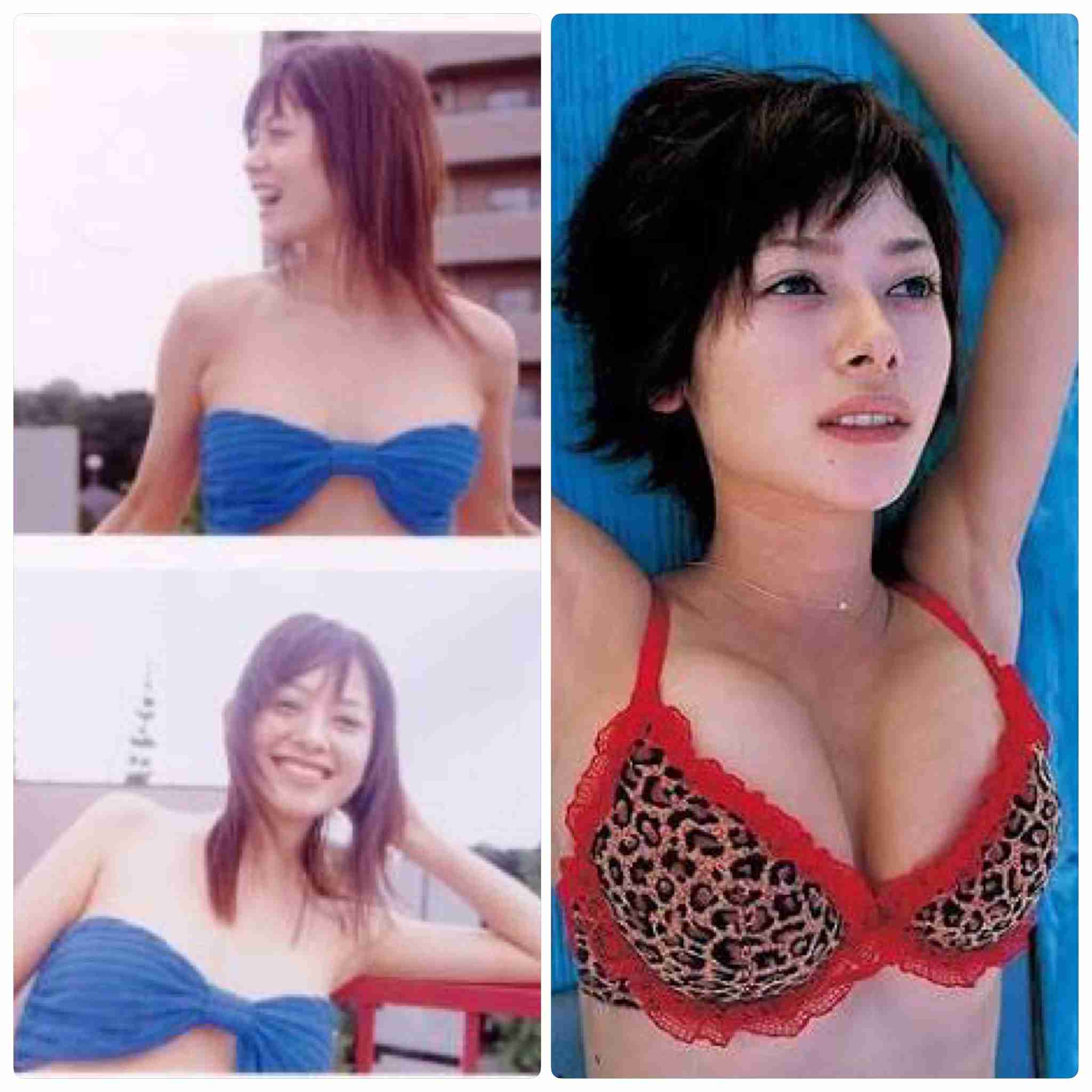 芸能人の整形アンケート調査【プラマイ】