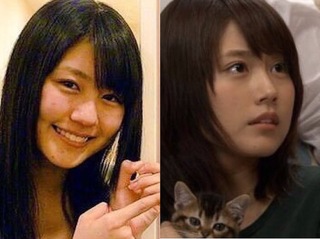 芸能人の整形アンケート調査【プラマイ】