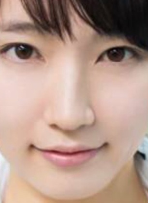 芸能人の整形アンケート調査【プラマイ】