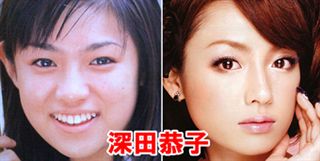 芸能人の整形アンケート調査【プラマイ】