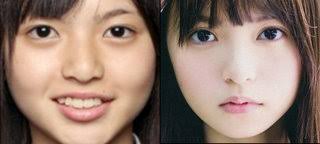 芸能人の整形アンケート調査【プラマイ】