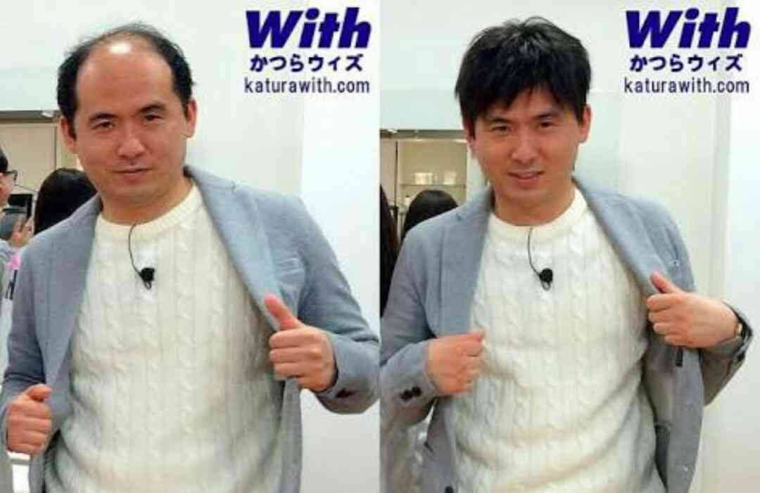 トレンディエンジェル斎藤司がパパに 第1子誕生「親の仇か、というくらい毛がフサフサです!」