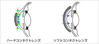 ハードコンタクト 愛用者のアイメイク