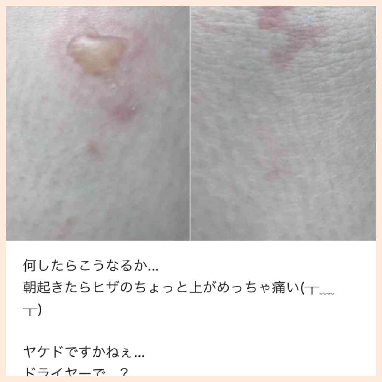 痛いSNS等の特徴