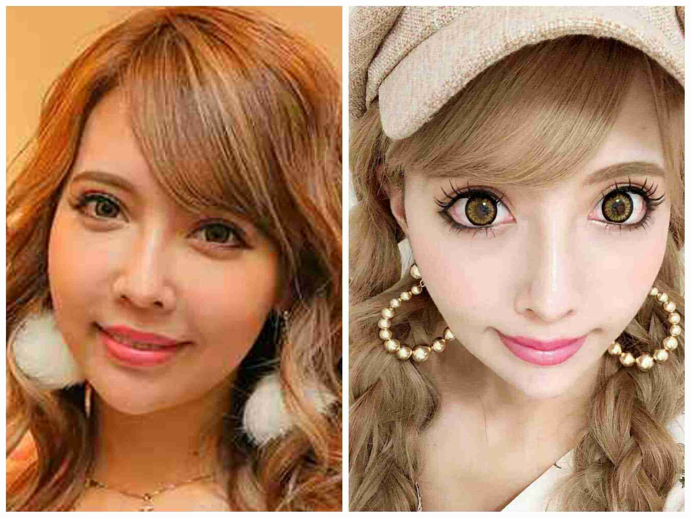双子モデルの妹・ 吉川ちか「270万円かけて整形します」