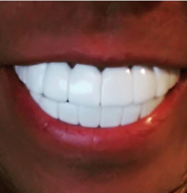 【実況・感想】ミュージックフェア 浜崎あゆみ 20周年スペシャル