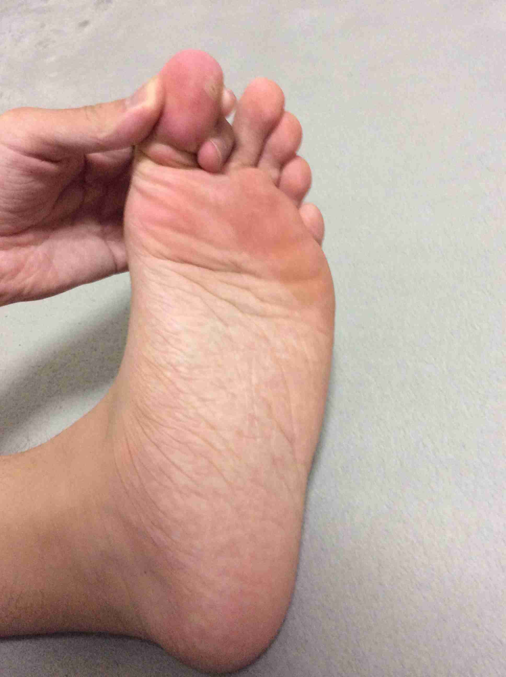 これはほぼ100%だっていうことを挙げるトピ